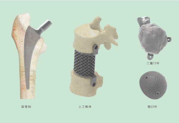 三維打印髖關(guān)節(jié)技術(shù)新動(dòng)態(tài)，重塑生活的科技魔法奇跡