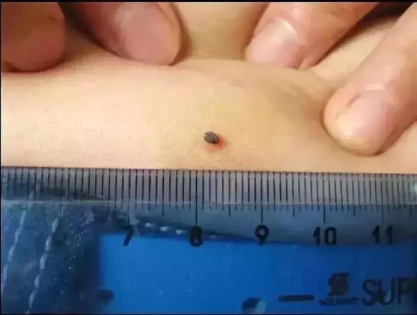 小明快樂疫情日志，最新疫情發(fā)布與日常觀察