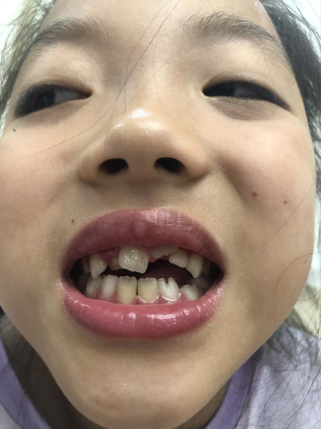 莊最新牙齒技術揭秘，牙齒美容新選擇