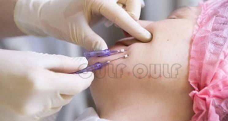 線雕最新手法，背景、發(fā)展、時(shí)代地位及展望